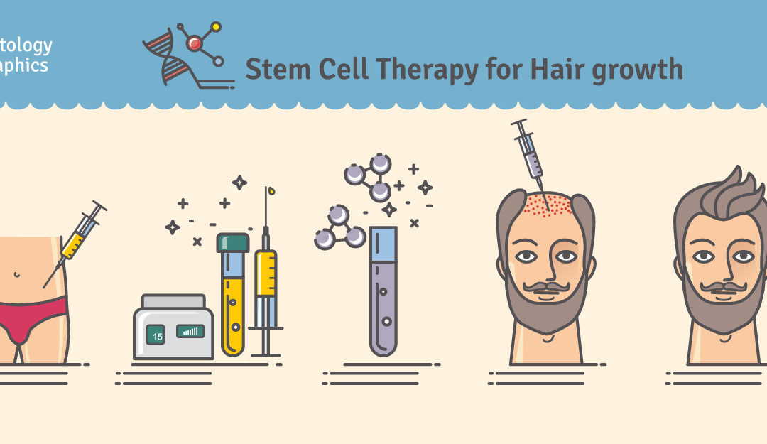 Should you get a stem cell treatment to improve your hair, skin and hips?